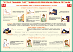 Таблица "Порядок действий при опасном кровотечении" (100х140 сантиметров, винил) - fgospostavki.ru - Златоуст