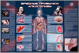 Электрифицированный стенд "Вредные привычки: алкоголизм" - fgospostavki.ru - Златоуст